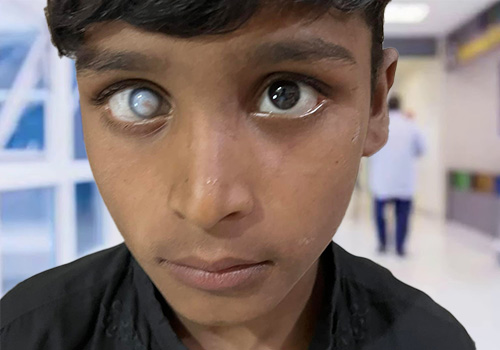 Retina Detachment Children